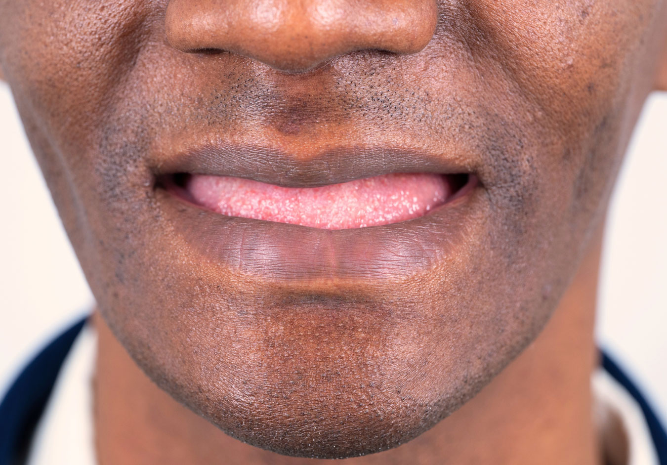 Close up of a person smiling warmly with no visible teeth.