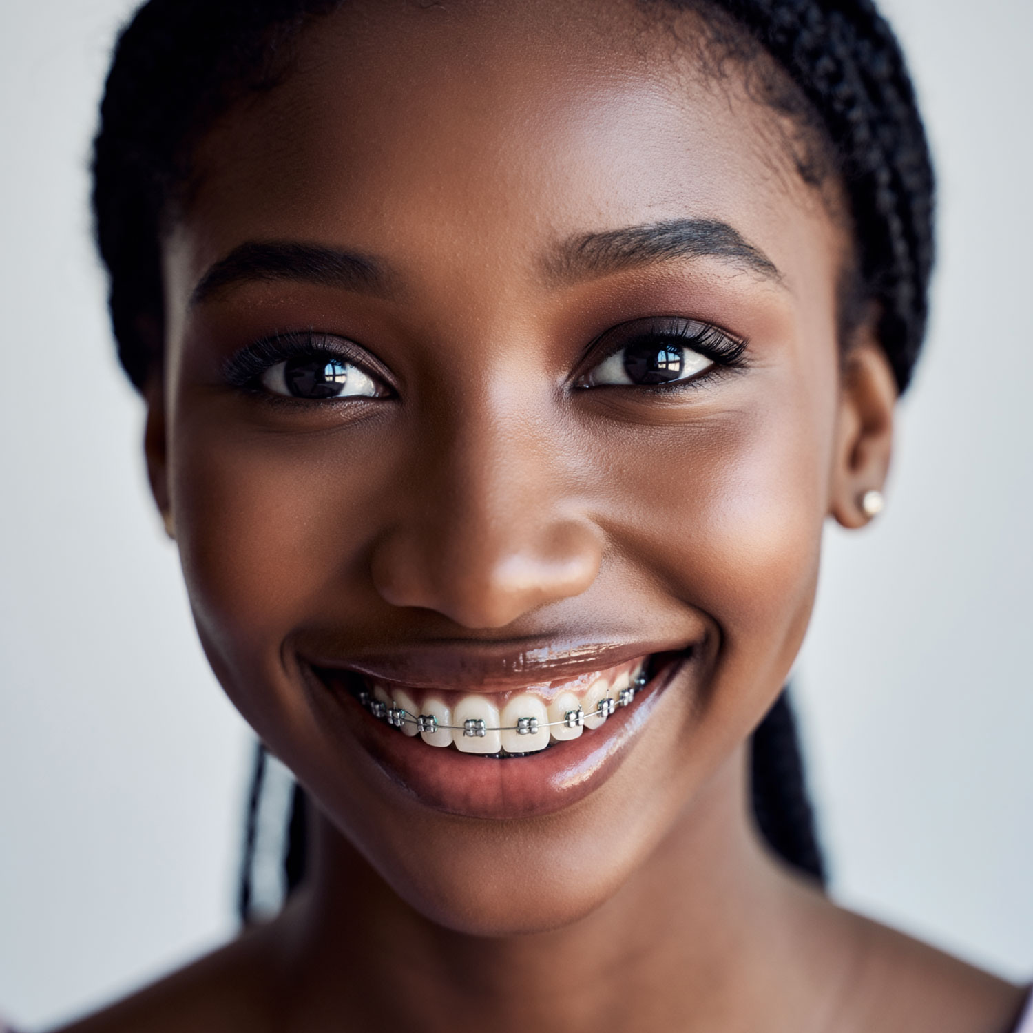 Close-up of a smiling young woman wearing metal braces on her teeth.