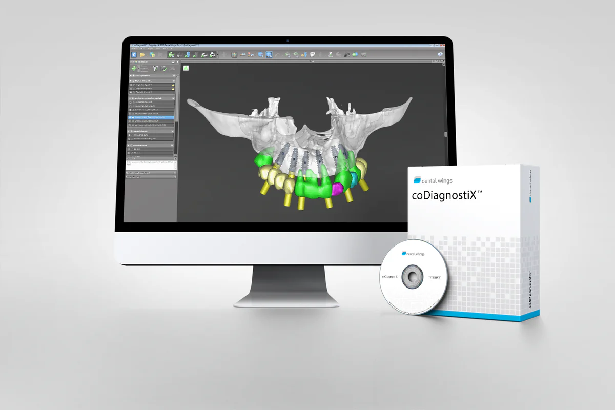 A digital design of implants displayed on a computer screen with Co diagnostiX software kit.